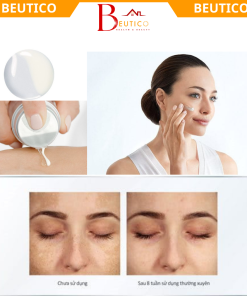 Tinh Chất Serum Giảm Thâm Nám Tàn Nhang Dưỡng Trắng Sáng Da Eucerin Spotless Brightening Double Booter Serum 30ML